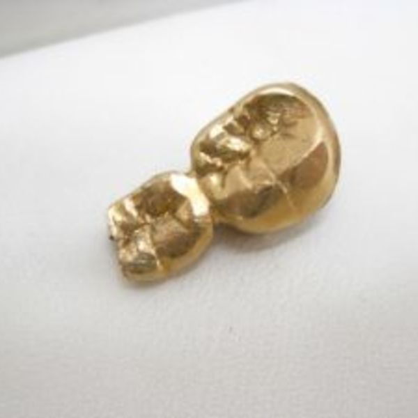 羽生市の方も金歯の無料査定・高価買取ならスリーアローズ鴻巣店へ